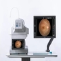High Resolution Automated Fundus Camera Red Free 50 Degrees