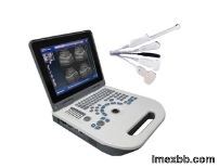 TGC Control Notebook Ultrasound Scanner For Pregnancy Home Use