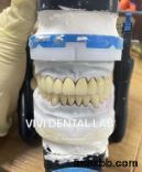 Digital CAD CAM Dental Lab Crowns Translucent Layered Zirconia Crown