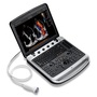 portable vascular ultrasound
