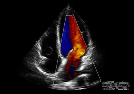 auto IMT,4D ultrasound,telemedicine,128 physical channel