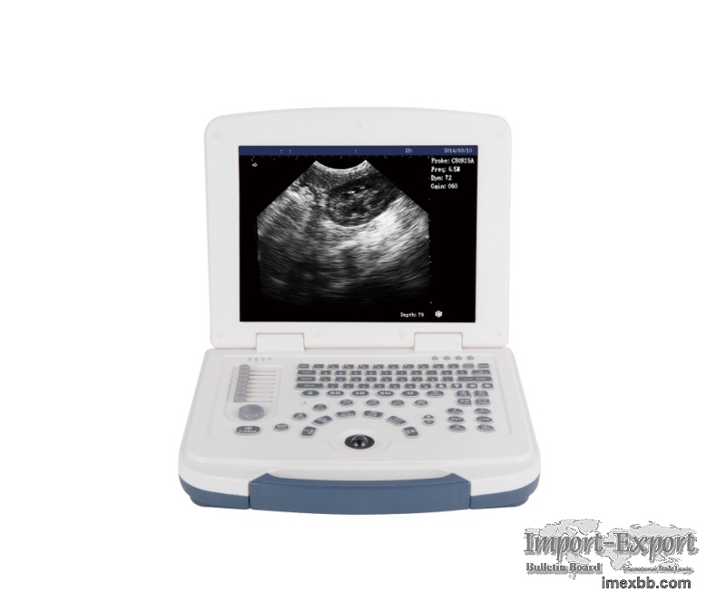 Portable Veterinary Ultrasound Diagnostic System for Efficient Pet Care Sol